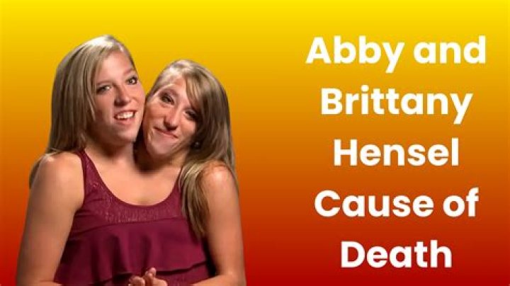 Understanding The Mystery Surrounding Abby And Brittany Hensel's Cause Of Death