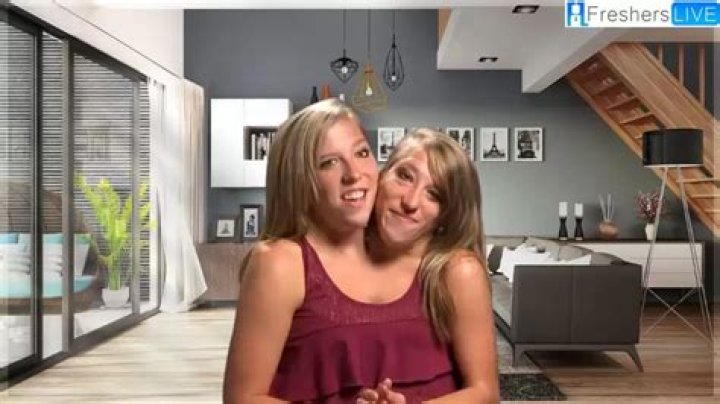 Unraveling The Lives Of Abby And Brittany Hensel: Are They Still Alive?