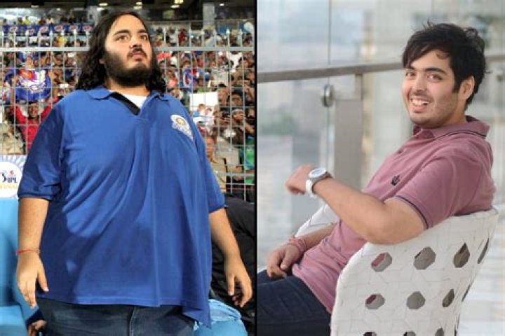 Anant Ambani's Journey: The Treatment That Changed His Life