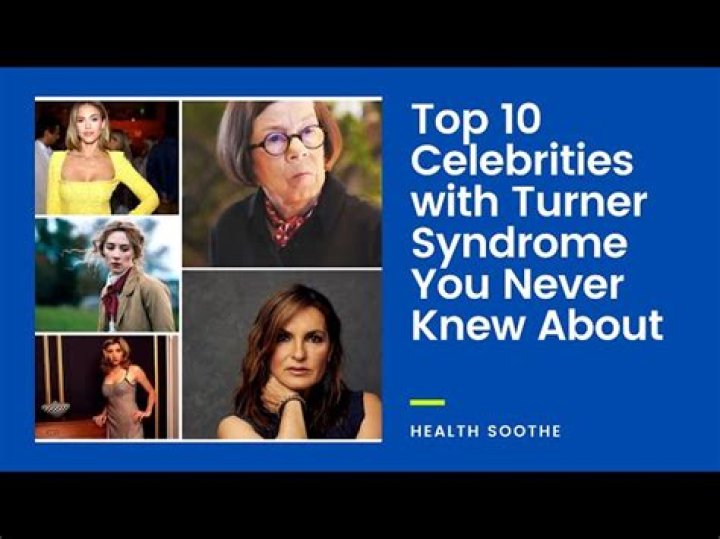 Courage And Strength: Celebrities With Turner's Syndrome