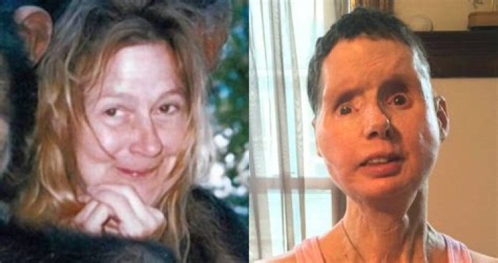 The Tragic Story Of Charla Nash: The Woman Who Survived A Chimp Attack