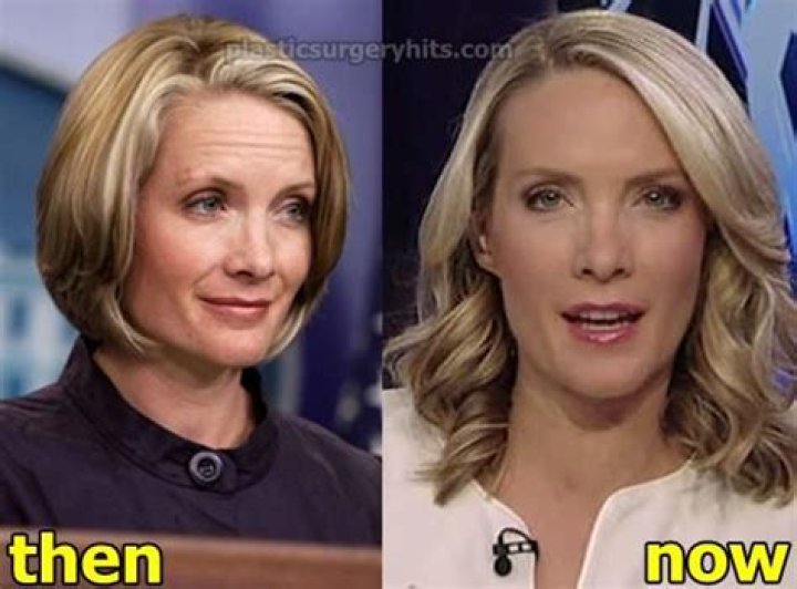 Dana Perino's Journey: The Truth Behind Her Transformation