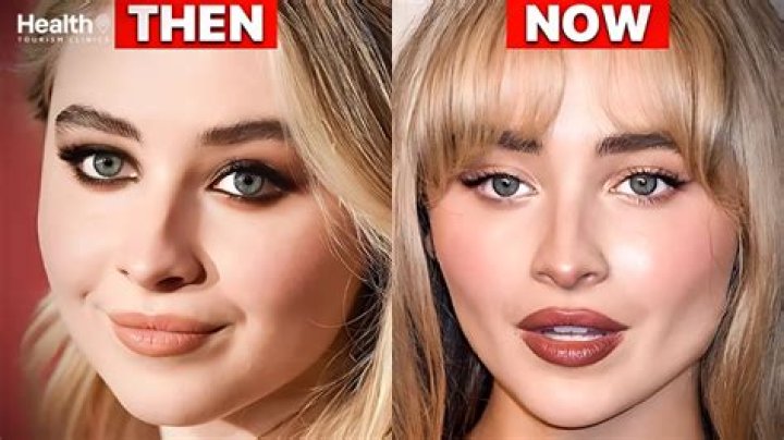 Did Sabrina Carpenter Really Get Face Fillers? The Surprising Truth