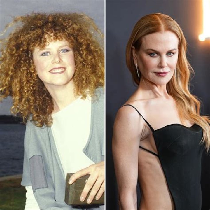The Truth About Nicole Kidman's Freckles: Does She Have Them?