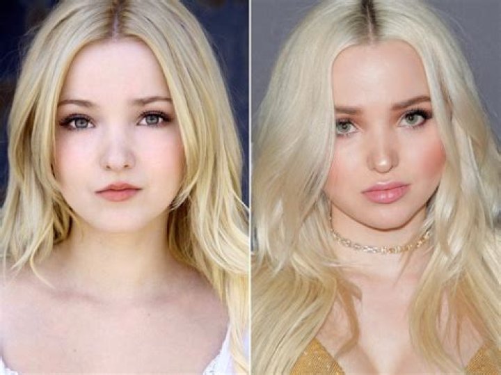 A Look At Dove Cameron Before She Became Famous