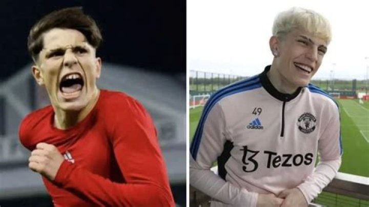 Unveiling Garnacho: The Truth Behind His Face Surgery