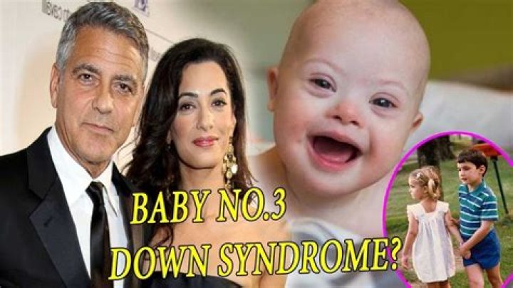George Clooney's Journey With His Twins And Down Syndrome Awareness