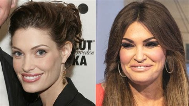 Kimberly Guilfoyle Before And After: Unveiling Her Transformation