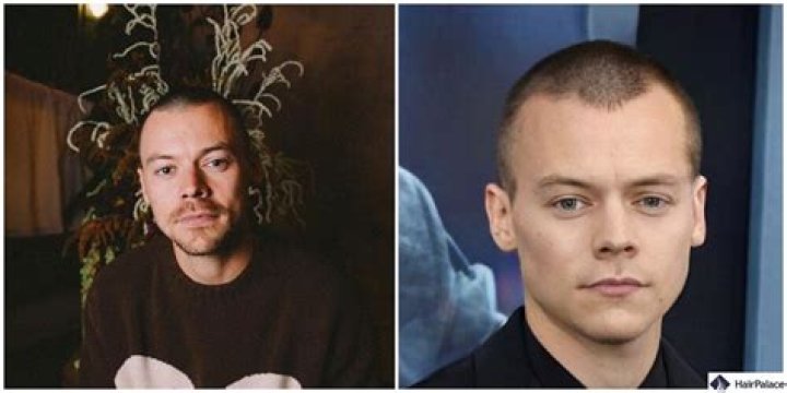 The Curious Case: Harry Styles' Journey Of Losing And Regaining Hair