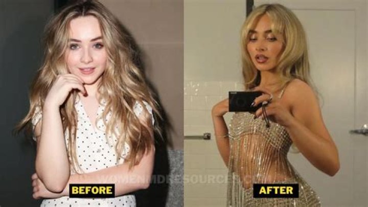 Did Sabrina Carpenter Go Under The Knife? Exploring Alleged Plastic Surgery Rumors