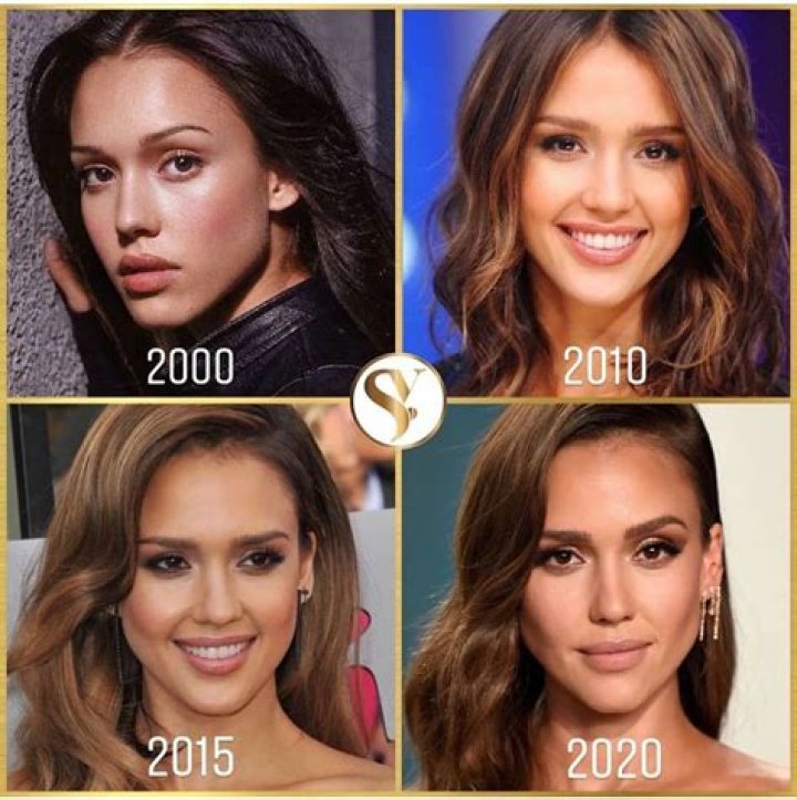 Jessica Alba's Lip Injections: A Closer Look