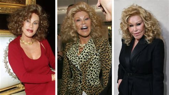 The Enigmatic Transformation Of Jocelyn Wildenstein: A Journey Of Excess And Controversy