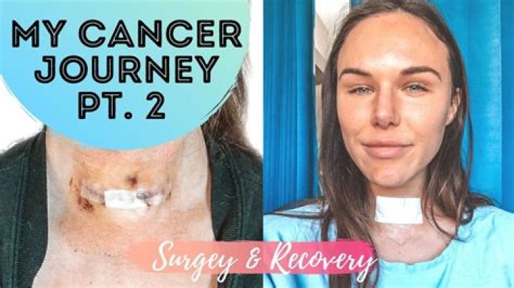 All About Joyce Vance Thyroid Surgery: What You Need To Know