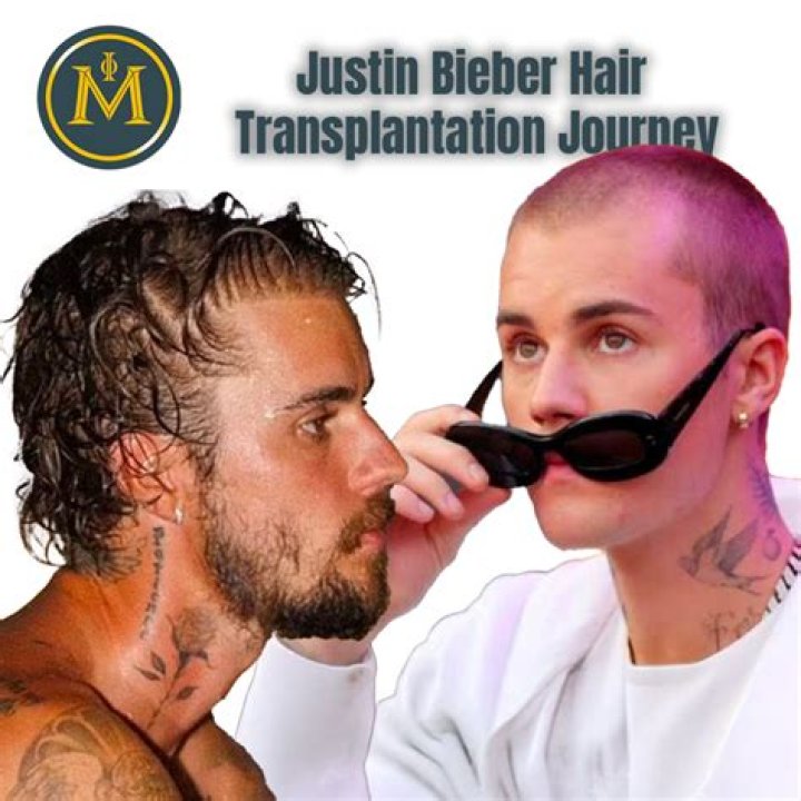 Justin Bieber's Hair Transformation: Uncovering The Secrets Of His Hair Regrowth