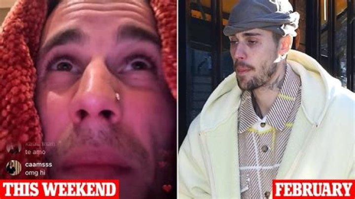 Unraveling The Mystery: Why Justin Bieber Looks Sick