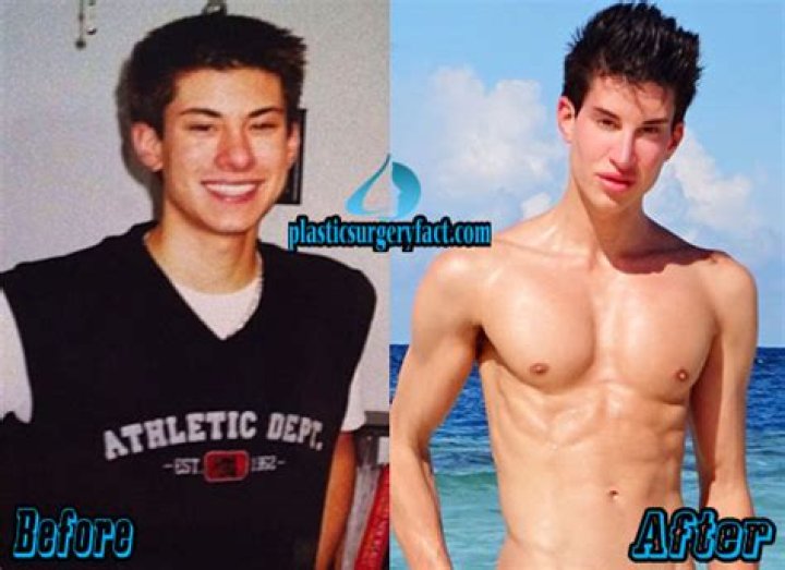 Transformations Of Justin Jedlica: A Look At His Journey Before And After