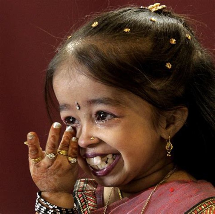 Jyoti Amge: A Glimpse Of Her Life As A Baby
