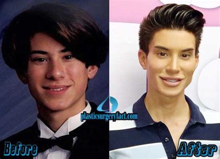 Transformations: The Ken Doll Before Surgery