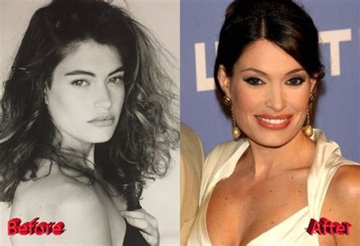 Unveiling The Transformation: Kim Guilfoyle Before And After