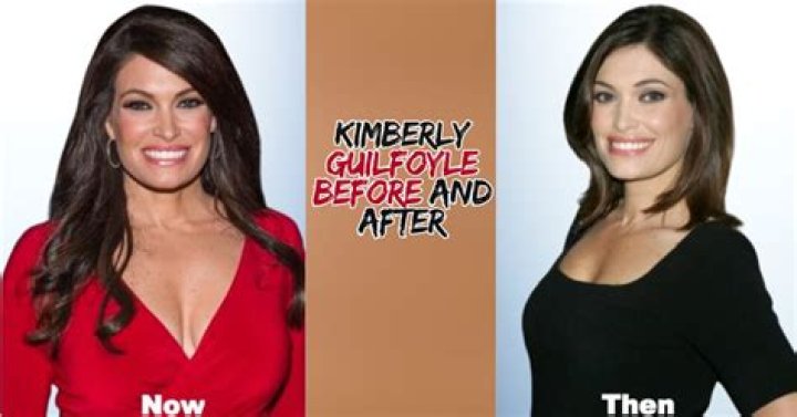 Unveiling The Journey: Kimberley Guilfoyle Before Fame