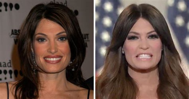 Transformative Journey: Kimberly Ann Guilfoyle Before And After