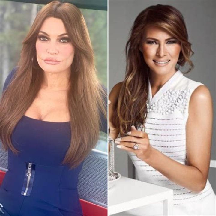 Unbelievable Transformation: Kimberly Guilfoyle's Plastic Surgery Journey