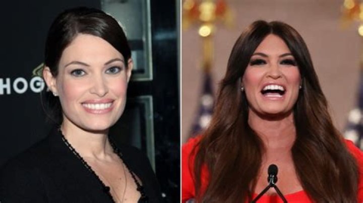Understanding Kimberly Guilfoyle Before Surgery: A Journey Of Transformation