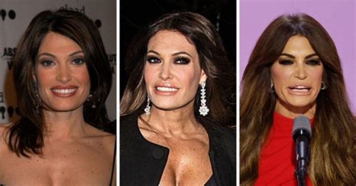 Unveiling Kimberly Guilfoyle Over The Years: A Journey Of Evolution