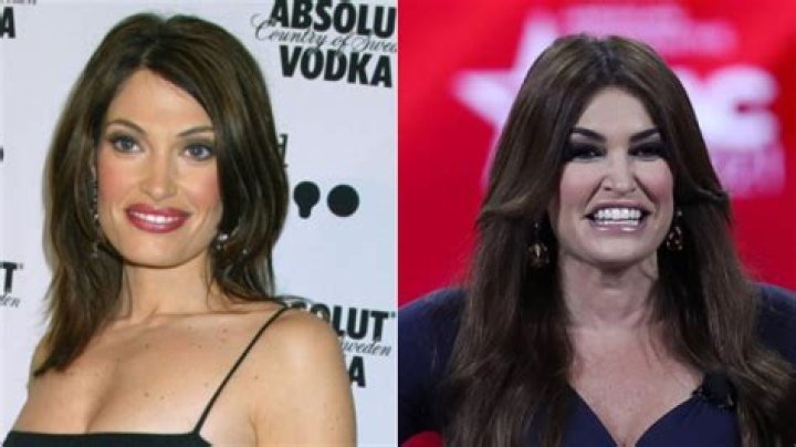 Kimberly Guilfoyle: The Transformation And Speculations Surrounding Her Face