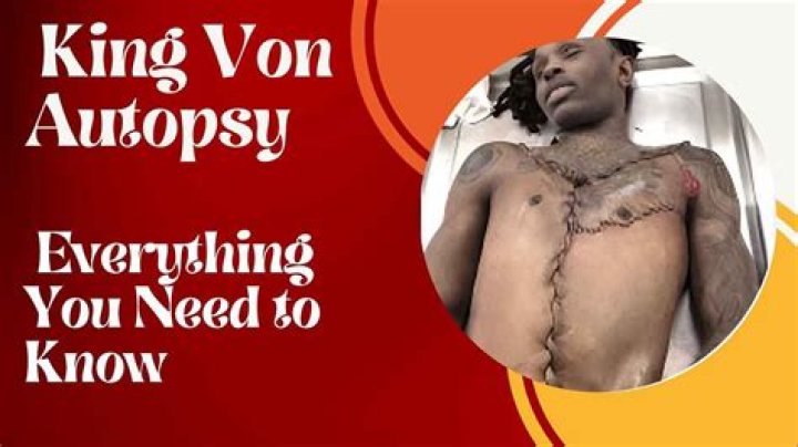 Unraveling The Mystery Of King Von's Autopsy Table