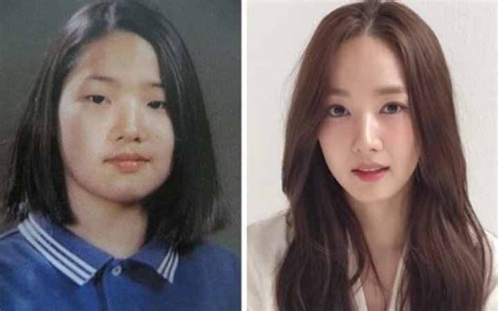 Korean Actress With Plastic Surgery: The Beauty Behind The Transformation