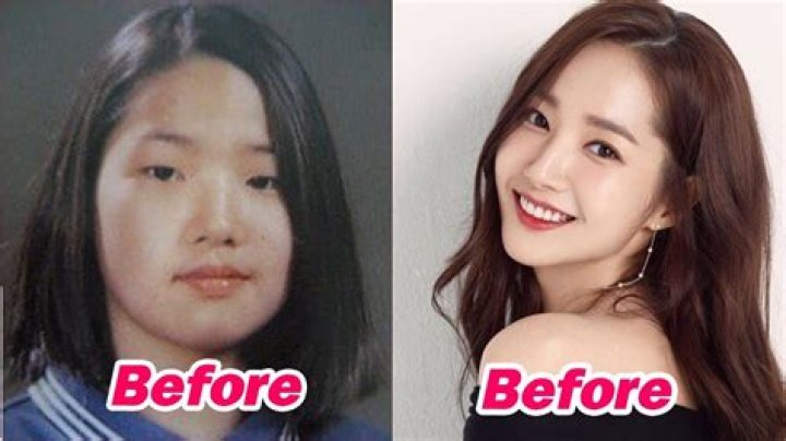 Korean Actresses And The Plastic Surgery Phenomenon