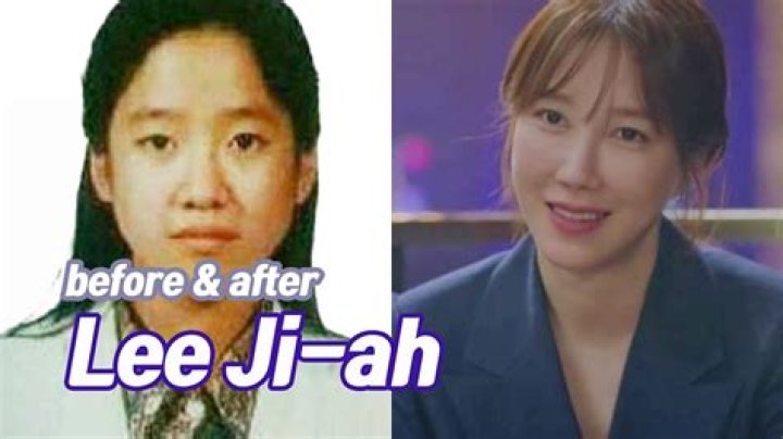 Unveiling The Truth: Lee Ji Ah And Her Plastic Surgery Journey