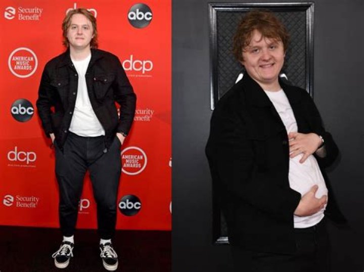 Lewis Capaldi's Weight Loss Journey: How He Transformed His Body