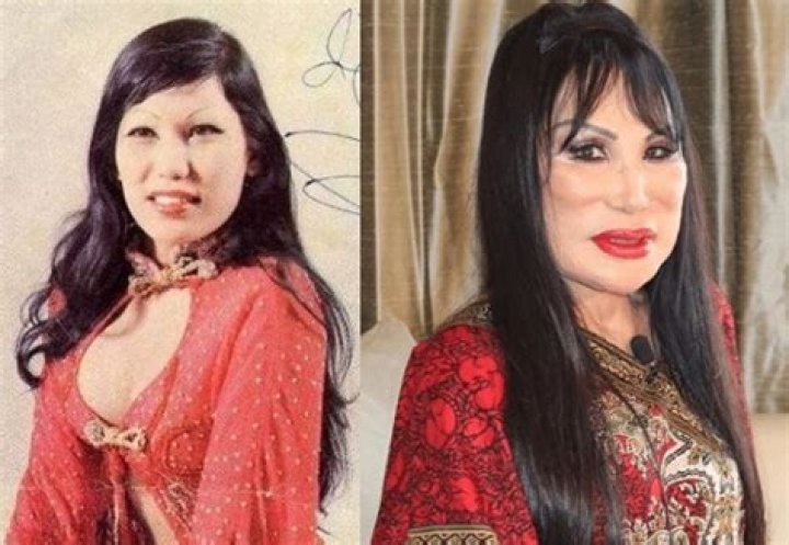 Exploring Lyn May Antes De Cirugias: A Journey Of Transformation