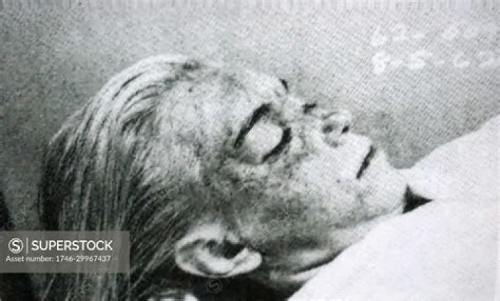 Witness The Unveiled: Marilyn Monroe's Autopsy Photo Unveiled