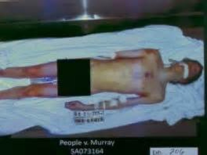 Shocking Michael Jackson Autopsy Photo Reveals Graphic Details