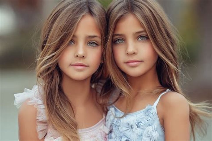 Captivating Charisma: The Most Beautiful Twins Of Our Time
