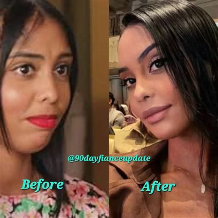 The Ultimate Guide To Nicole Before Surgery