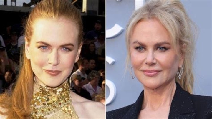 Surprising Evolution Of Nicole Kidman's Face: A Timeline Of Transformations