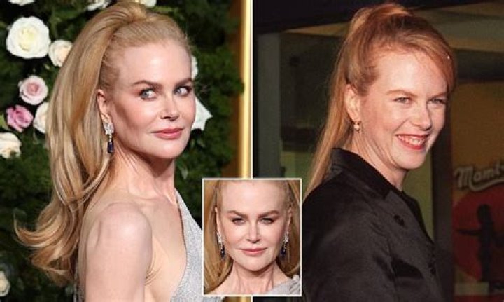 Nicole Kidman's Plastic Surgery Journey In The Northman