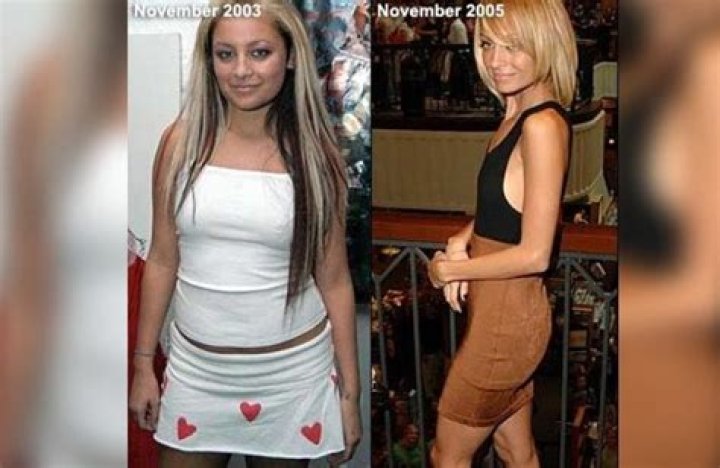 Nicole Richie: A Stunning Transformation - Before And After