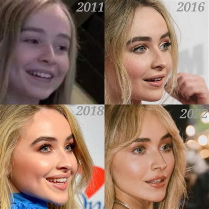 Sabrina Carpenter Cosmetic Surgery: The Truth Revealed