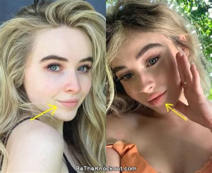 Proof Of Sabrina Carpenter's Lip Injections: The Unseen Truth