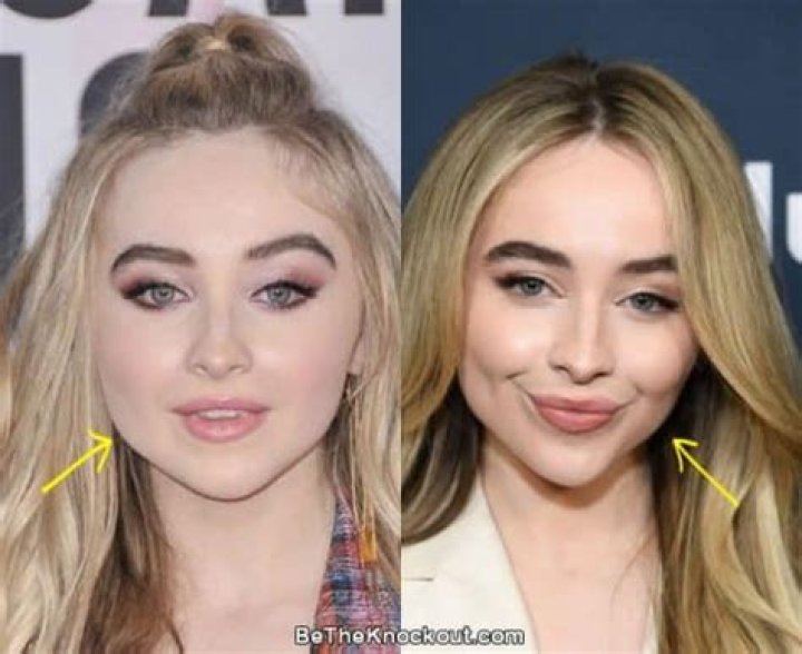 Top Secrets Of Sabrina Carpenter's Plastic Surgery Transformation