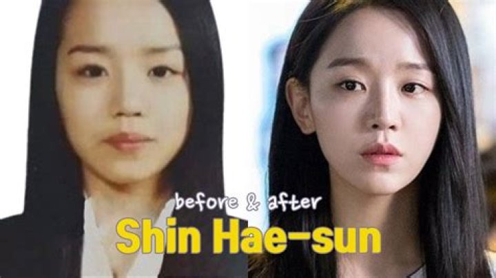 Unveiling The Truth: Shin Hye-sun's Plastic Surgery Journey