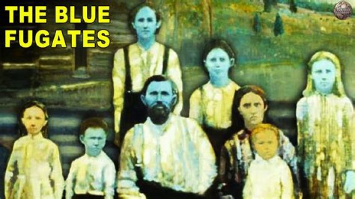 The Enigmatic Blue People Of West Virginia